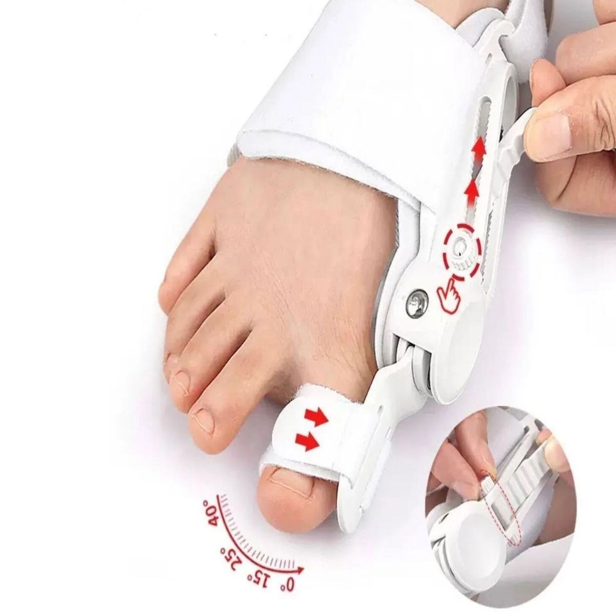 Ayarlanabilir Ayak Baş Parmak Kemik Düzeltici – Halluks Valgus (Bunyon) Aparatı, Gece Gündüz Kullanıma Uygun Ayak Düzeltme Ateli (5563)