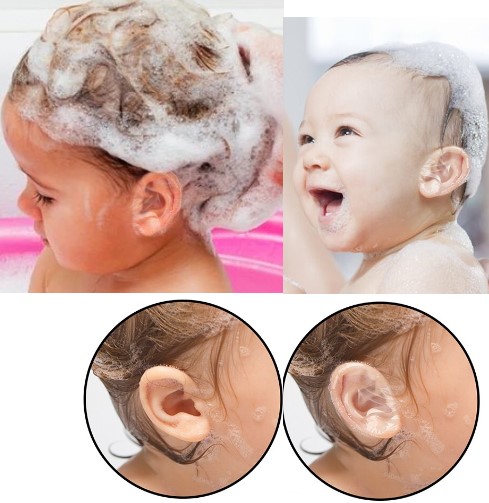 Wasserdichtes Ohrenklebeband 10er Pack (5563)