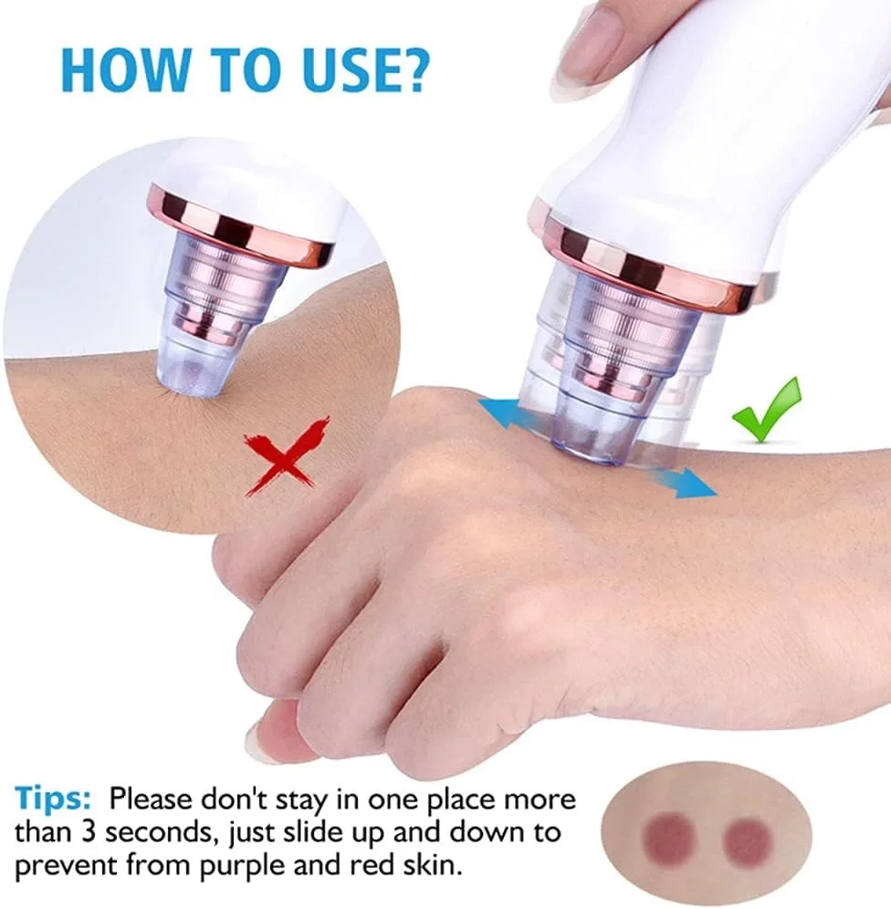 Şarjlı Siyah Nokta Temizleme Cihazı 5 Başlıklı (5563) #3