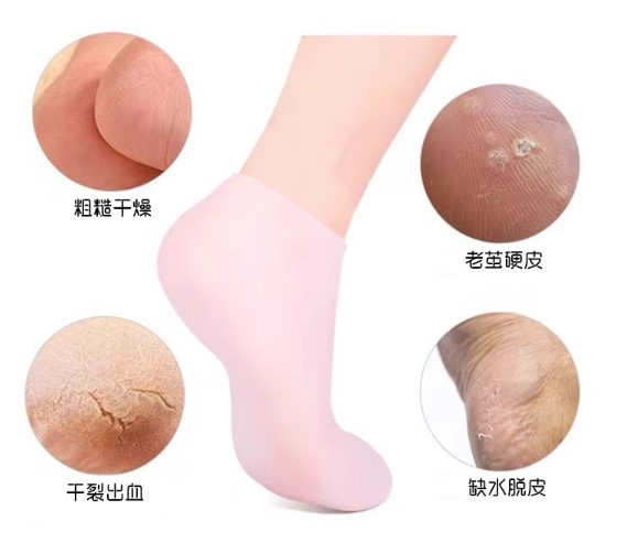 Silikon Nemlendirici Çorap Ayak Bakım Çorabı (5563) #2