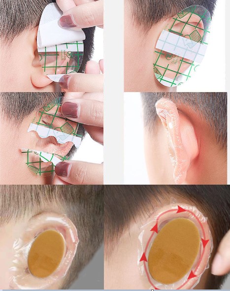 Su Geçirmez Yapışkanlı Kulak Koruyucu Bant 10 lu Paket (5563) #3